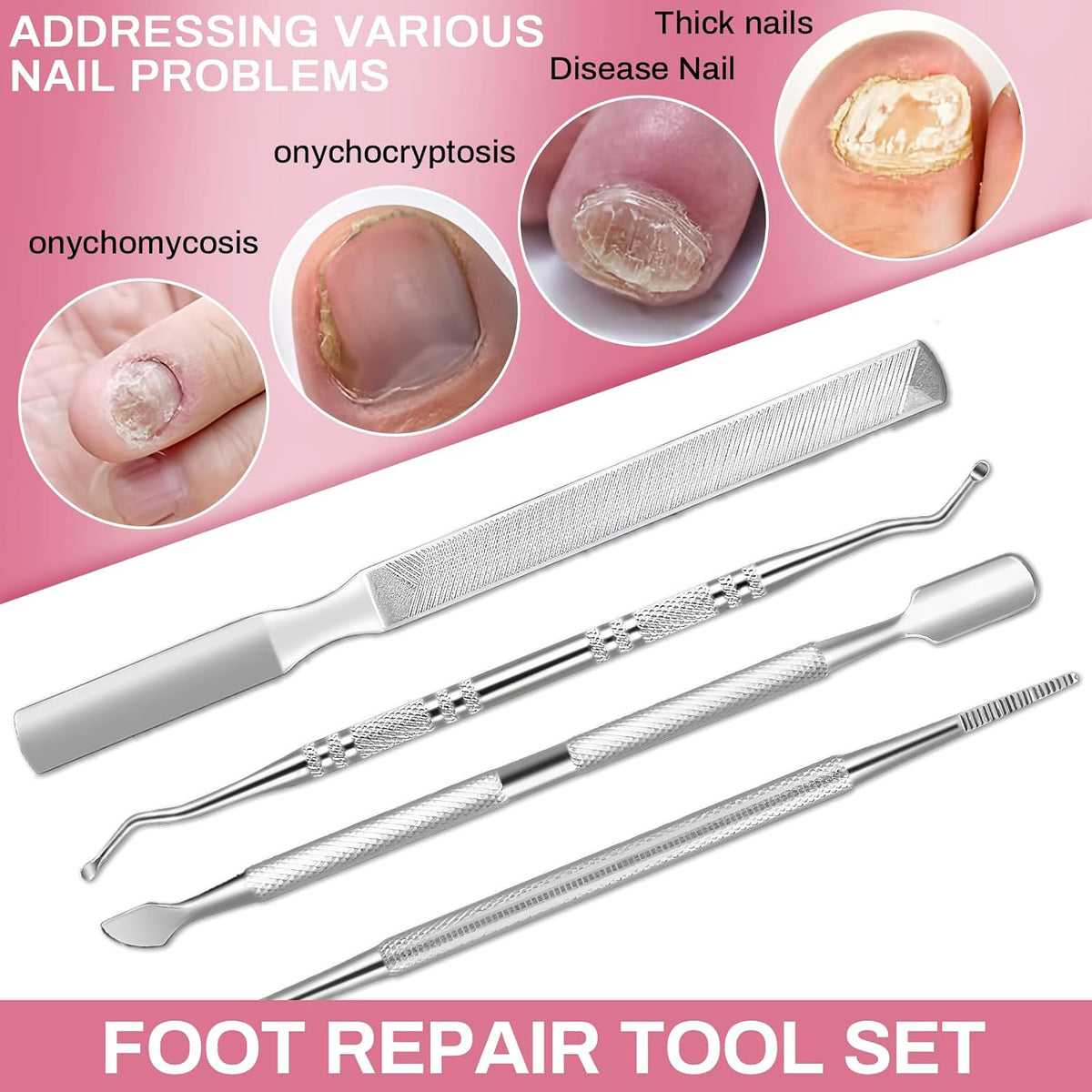Ylinwtech 4 Stück Pediküre Werkzeuge,Metall Nagelfeilen,Nail File Set,Foot Care & Leisure Eignet Sich Zum Abschleifen Der Füße Und Zur Reinigung Von Dicker Fußhaut